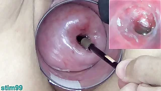 Mature Milf Cervix Play with Endoscope Japanese Cam into Uterus